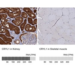 beta L Crystallin Polyclonal Antibody:Antibodies, Polyclonal