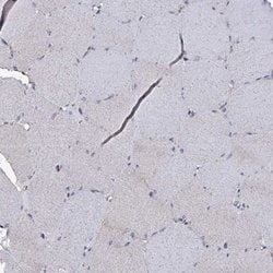 beta L Crystallin Polyclonal Antibody:Antibodies, Polyclonal