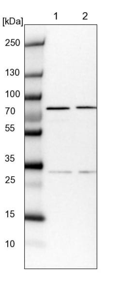 Invitrogen COG6 Polyclonal Antibody 100 &mu;L; Unconjugated:Antibodies,