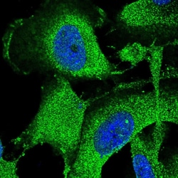 Invitrogen SPG11 Polyclonal Antibody 100 &mu;L; Unconjugated:Antibodies,