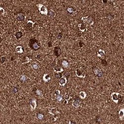 Invitrogen KLC2 Polyclonal Antibody 100 &mu;L; Unconjugated:Antibodies,