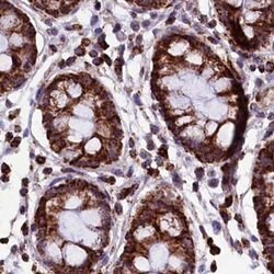 Invitrogen KLC2 Polyclonal Antibody 100 &mu;L; Unconjugated:Antibodies,