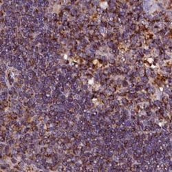 Invitrogen KLC2 Polyclonal Antibody 100 &mu;L; Unconjugated:Antibodies,