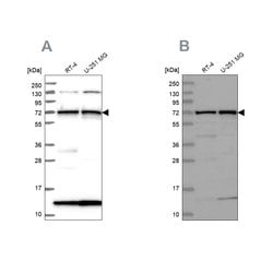 Invitrogen KLC2 Polyclonal Antibody 100 &mu;L; Unconjugated:Antibodies,