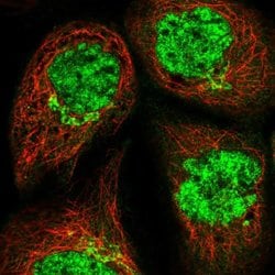 Invitrogen COG6 Polyclonal Antibody 100 &mu;L; Unconjugated:Antibodies,