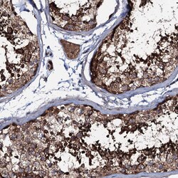 Invitrogen COG6 Polyclonal Antibody 100 &mu;L; Unconjugated:Antibodies,