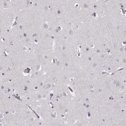 Invitrogen Cystatin F Polyclonal Antibody 100 &mu;L; Unconjugated:Antibodies,