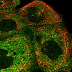 Invitrogen JLP Polyclonal Antibody 100 &mu;L; Unconjugated:Antibodies,