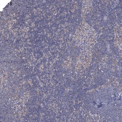 Invitrogen JLP Polyclonal Antibody 100 &mu;L; Unconjugated:Antibodies,
