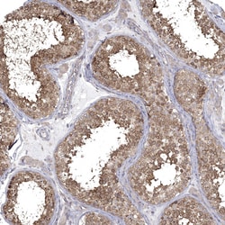 Invitrogen JLP Polyclonal Antibody 100 &mu;L; Unconjugated:Antibodies,