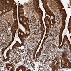 Invitrogen REP15 Polyclonal Antibody 100 &mu;L; Unconjugated:Antibodies,
