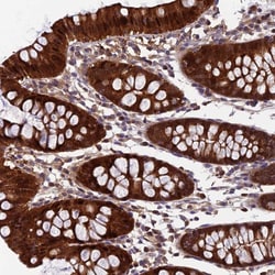 Invitrogen CCDC15 Polyclonal Antibody 100 &mu;L; Unconjugated:Antibodies,
