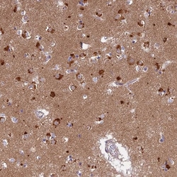 Invitrogen LYSMD2 Polyclonal Antibody 100 &mu;L; Unconjugated:Antibodies,