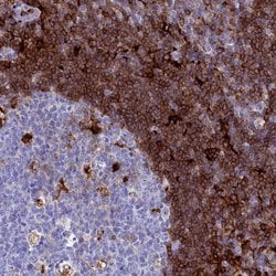 Invitrogen PLAC8 Polyclonal Antibody 100 &mu;L; Unconjugated:Antibodies,