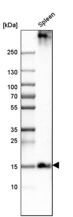 Invitrogen PLAC8 Polyclonal Antibody 100 &mu;L; Unconjugated:Antibodies,