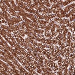 Invitrogen ST3GAL1 Polyclonal Antibody 100 &mu;L | Buy Online | Invitrogen&trade; | Fisher Scientific