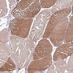 Invitrogen ST3GAL1 Polyclonal Antibody 100 &mu;L | Buy Online | Invitrogen&trade; | Fisher Scientific
