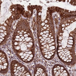 Invitrogen ULK3 Polyclonal Antibody 100 &mu;L; Unconjugated:Antibodies,