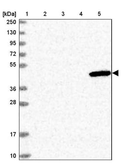 Invitrogen ULK3 Polyclonal Antibody 100 &mu;L; Unconjugated:Antibodies,