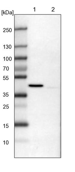 Invitrogen ULK3 Polyclonal Antibody 100 &mu;L; Unconjugated:Antibodies,