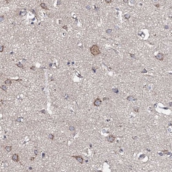 Invitrogen GLCE Polyclonal Antibody 100 &mu;L; Unconjugated:Antibodies,