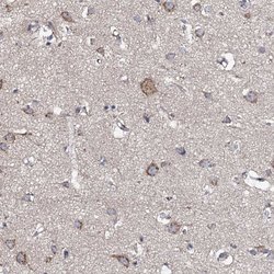 Invitrogen GLCE Polyclonal Antibody 100 &mu;L; Unconjugated:Antibodies,