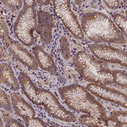 Invitrogen C15orf52 Polyclonal Antibody 100 &mu;L; Unconjugated:Antibodies,