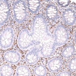 Invitrogen Kindlin 2 Polyclonal Antibody 100 &mu;L; Unconjugated:Antibodies,