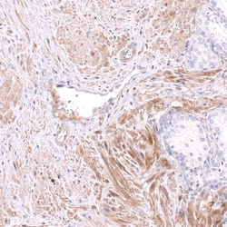 Invitrogen Kindlin 2 Polyclonal Antibody 100 &mu;L; Unconjugated:Antibodies,