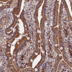 Invitrogen SLC16A14 Polyclonal Antibody 100 &mu;L; Unconjugated:Antibodies,