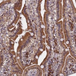 Invitrogen SLC16A14 Polyclonal Antibody 100 &mu;L; Unconjugated:Antibodies,