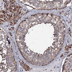 Invitrogen NRIP3 Polyclonal Antibody 100 &mu;L; Unconjugated:Antibodies,