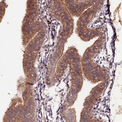 Invitrogen PLXNB1 Polyclonal Antibody 100 &mu;L | Buy Online | Invitrogen&trade; | Fisher Scientific