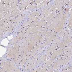 Invitrogen PLXNB1 Polyclonal Antibody 100 &mu;L | Buy Online | Invitrogen&trade; | Fisher Scientific