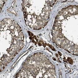 Invitrogen TPGS2 Polyclonal Antibody 100 &mu;L | Buy Online | Invitrogen&trade; | Fisher Scientific
