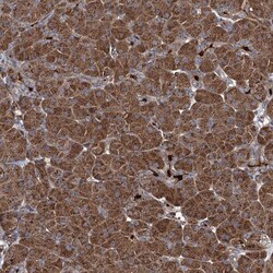 Invitrogen CCDC102A Polyclonal Antibody 100 &mu;L | Buy Online | Invitrogen&trade; | Fisher Scientific
