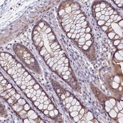 Invitrogen FOPNL Polyclonal Antibody 100 &mu;L; Unconjugated:Antibodies,