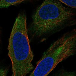 Invitrogen HAUS1 Polyclonal Antibody 100 &mu;L; Unconjugated:Antibodies,