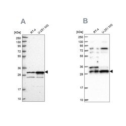 Invitrogen HAUS1 Polyclonal Antibody 100 &mu;L; Unconjugated:Antibodies,