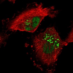 Invitrogen RPRD1A Polyclonal Antibody 100 &mu;L; Unconjugated:Antibodies,