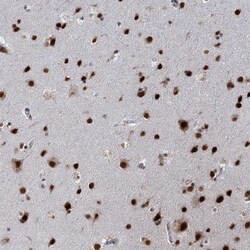 Invitrogen RPRD1A Polyclonal Antibody 100 &mu;L; Unconjugated:Antibodies,