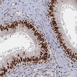Invitrogen RPRD1A Polyclonal Antibody 100 &mu;L; Unconjugated:Antibodies,