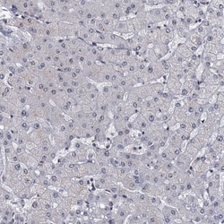 Invitrogen RPRD1A Polyclonal Antibody 100 &mu;L; Unconjugated:Antibodies,