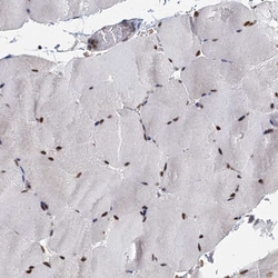 Invitrogen RPRD1A Polyclonal Antibody 100 &mu;L; Unconjugated:Antibodies,