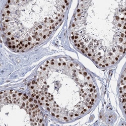 Invitrogen RPRD1A Polyclonal Antibody 100 &mu;L; Unconjugated:Antibodies,