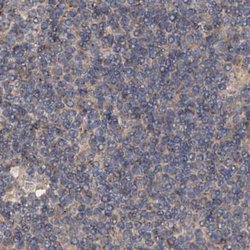 Invitrogen CEP68 Polyclonal Antibody 100 &mu;L; Unconjugated:Antibodies,