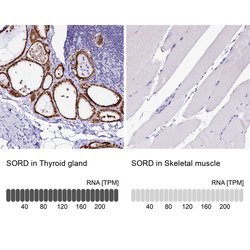Invitrogen Sorbitol Dehydrogenase Polyclonal Antibody 100 &mu;L; Unconjugated:Antibodies,