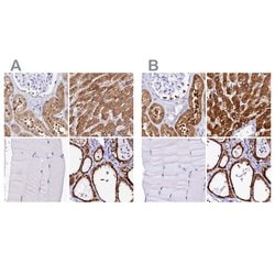 Invitrogen Sorbitol Dehydrogenase Polyclonal Antibody 100 &mu;L; Unconjugated:Antibodies,