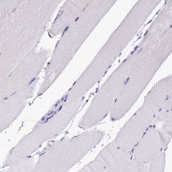 Invitrogen Sorbitol Dehydrogenase Polyclonal Antibody 100 &mu;L; Unconjugated:Antibodies,