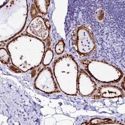 Invitrogen Sorbitol Dehydrogenase Polyclonal Antibody 100 &mu;L; Unconjugated:Antibodies,